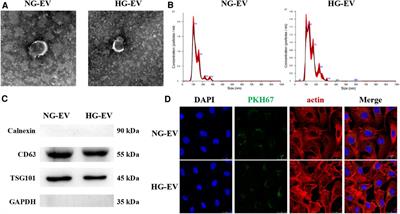 Extracellular vesicles derived from fibroblasts induced with or without high glucose exert opposite effects on wound healing and angiogenesis